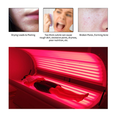 Rote Lichttherapie-Betten der Hautpflege-3.kw LED für Akne-Behandlung