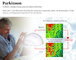 1 - Licht-Sturzhelm der Frequenz-20000Hz des Steuer810nm LED für Therapie Parkinson Alzheimer